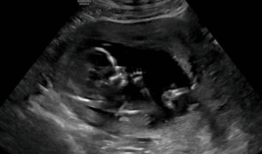From Bumps 2 Babies